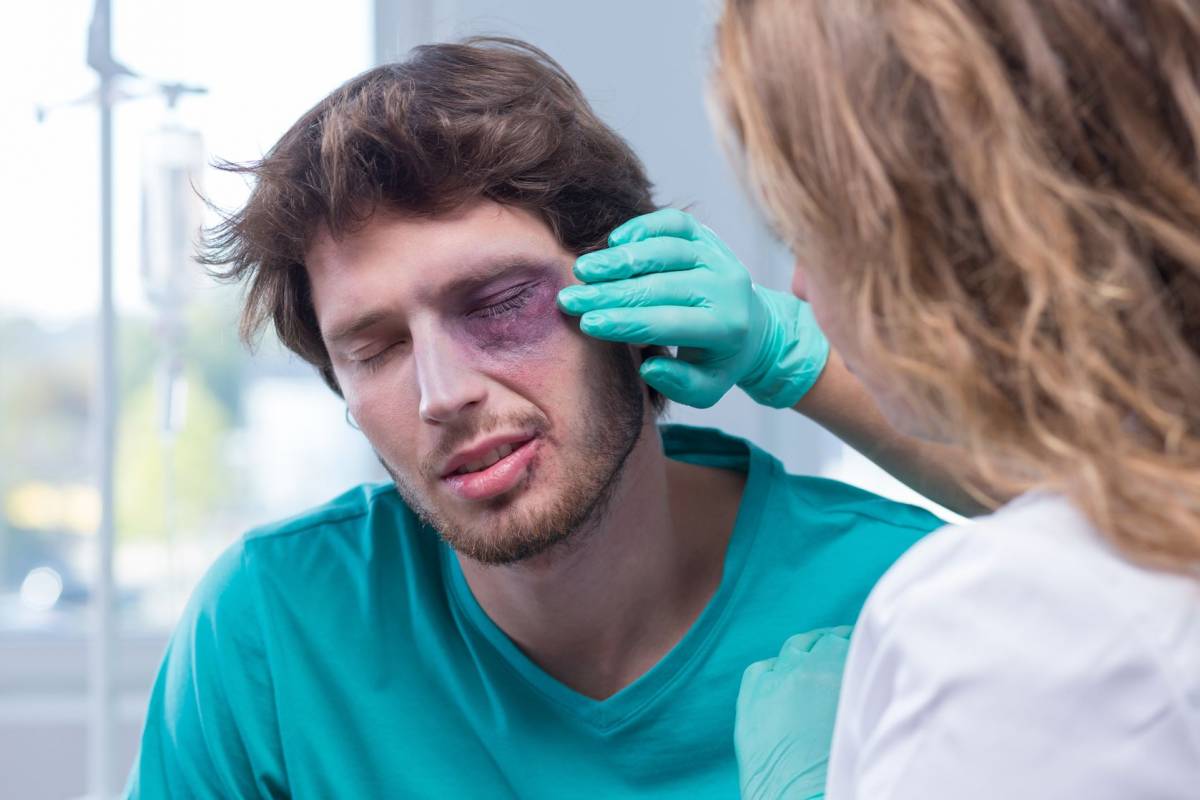 Blackeye