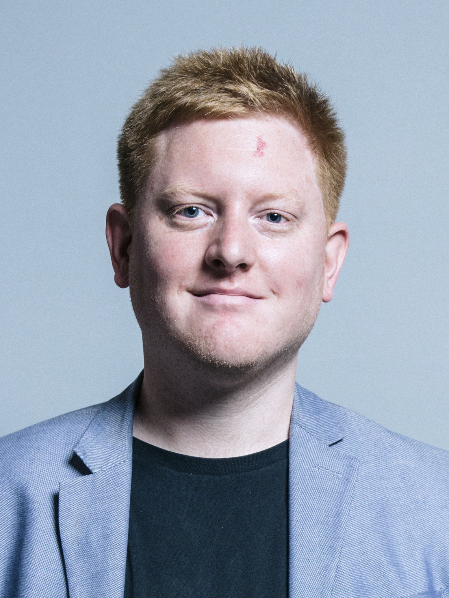 Country takes pity on Ginger Labour MP