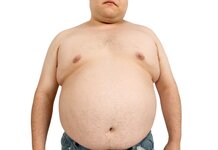 Put a top on, you’re not Poldark man told.